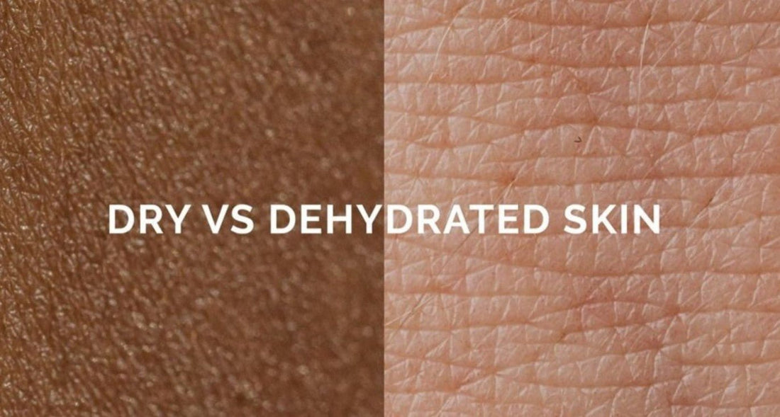 Dehydrated vs Dry Skin: How to Tell the Difference - Holistik Skincare 